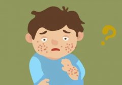 ���ϳ�ԲȦѢ��ԭ��Ӧ�Է���